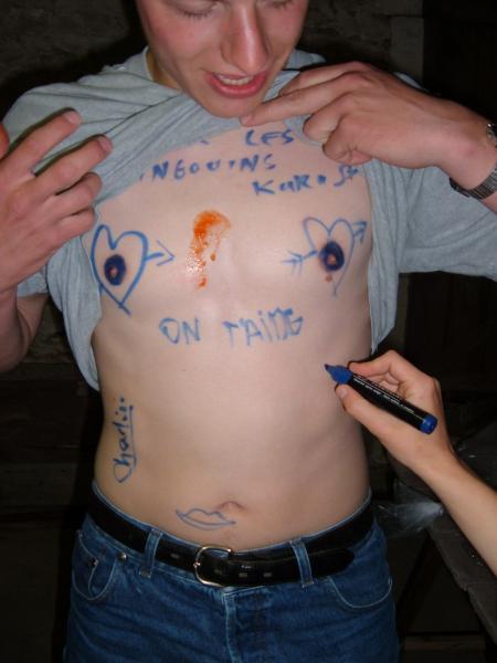 Berni et sa trace de ketchup